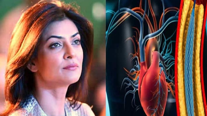 হার্ট অ্যাটাকের পর পুনরায় কাজে ফিরেছেন সুস্মিতা সেন হার্ট অ্যাটাকের পর পুনরায় কাজে ফিরেছেন সুস্মিতা সেন