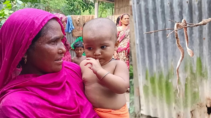 শিশুর কামড়ে সাপের মৃত্যু, ‘টক অব দ্য কান্ট্রি’