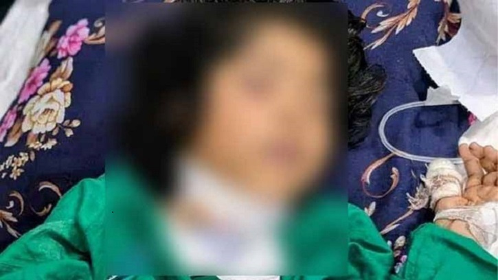 সীতাকুণ্ড থেকে উদ্ধার গলায় ছুরিকাঘাতে আহত শিশু মারা গেছে