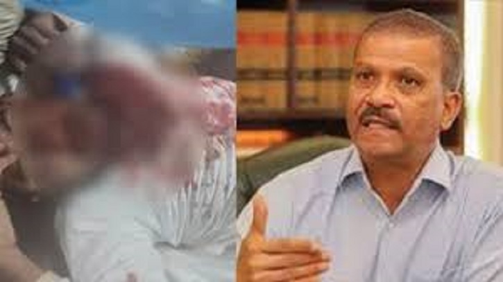 নুরের ওপর হামলার ঘটনায় আইন উপদেষ্টার নিন্দা নুরের ওপর হামলার ঘটনায় আইন উপদেষ্টার নিন্দা