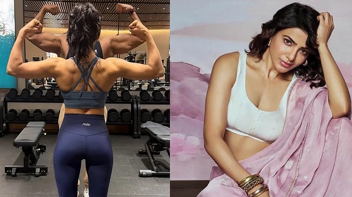 নিজের পিঠের পেশিবহুল ছবি শেয়ার করে জানালেন অভিজ্ঞতার কথা