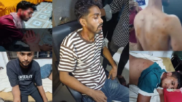 বেগমগঞ্জে গায়ে হলুদে যাওয়ার পথে গুলিবিদ্ধ পাঁচ