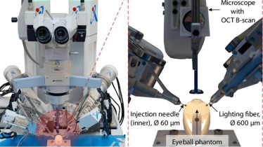 চোখের সার্জারি রোবট বানাল চীন চোখের সার্জারি রোবট বানাল চীন