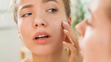 রোজায় ত্বক শুষ্ক হয়ে যাচ্ছে? যা করবেন