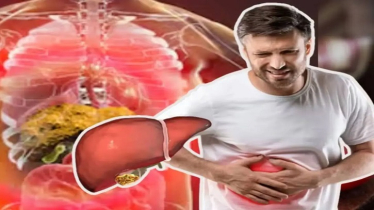 ফ্যাটি লিভার থাকলে কি হেপাটাইটিসের ঝুঁকি বাড়ে?