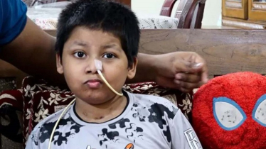 মাথায় কৃত্রিম খুলি নিয়ে ছোট্ট মুসার বেঁচে থাকা