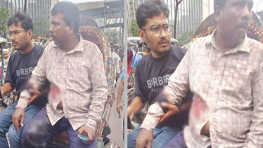  প্রকাশ্যে গুলি করে ১৭ লাখ টাকা ছিনতাই