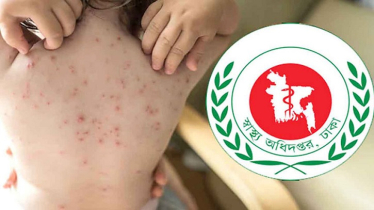 হাম উপসর্গে একদিনে আরও ৮ জনের মৃত্যু