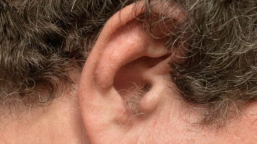 কানে চুল গজানো মানেই সৌভাগ্যের লক্ষণ? কী বলছে জ্যোতিষ শাস্ত্র 