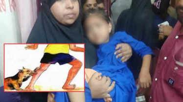 পাগলা কুকুরের কামড়ে পটুয়াখালীতে শিশুসহ আহত ১০