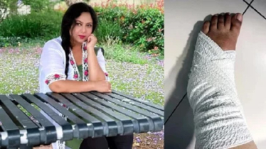 শাবনূরের পায়ে প্লাস্টার, হাঁটতে হচ্ছে ক্রাচে ভর দিয়ে