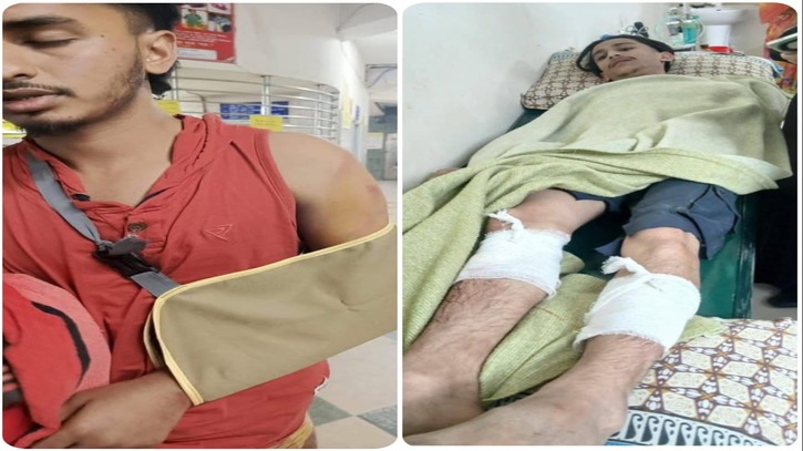 গাছবাড়িতে ছাত্রদলের দুই কর্মীসহ কিশোরকে পিটিয়ে পা ভাঙার অভিযোগ
