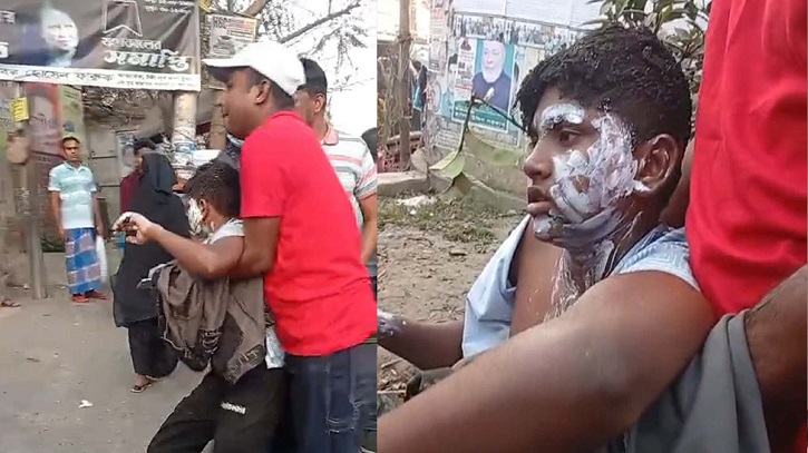 গ্যাস বেলুন বিস্ফোরণ,দগ্ধ ১৭ জনকে নেওয়া হচ্ছে বার্ন ইনস্টিটিউটে