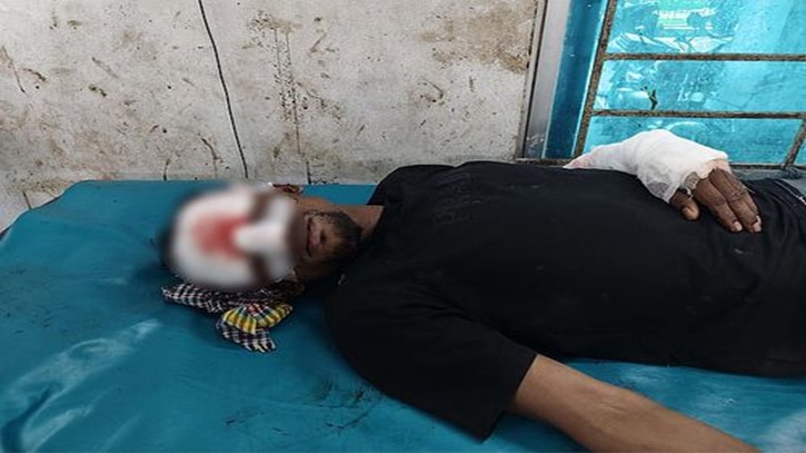 কোটালীপাড়ায় হাসপাতালে ঢুকে চিকিৎসাধীন যুবককে কুপিয়ে জখম